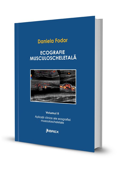 Vezi detalii pentru Ecografie musculoscheletală - Daniela Fodor - Vol. II
