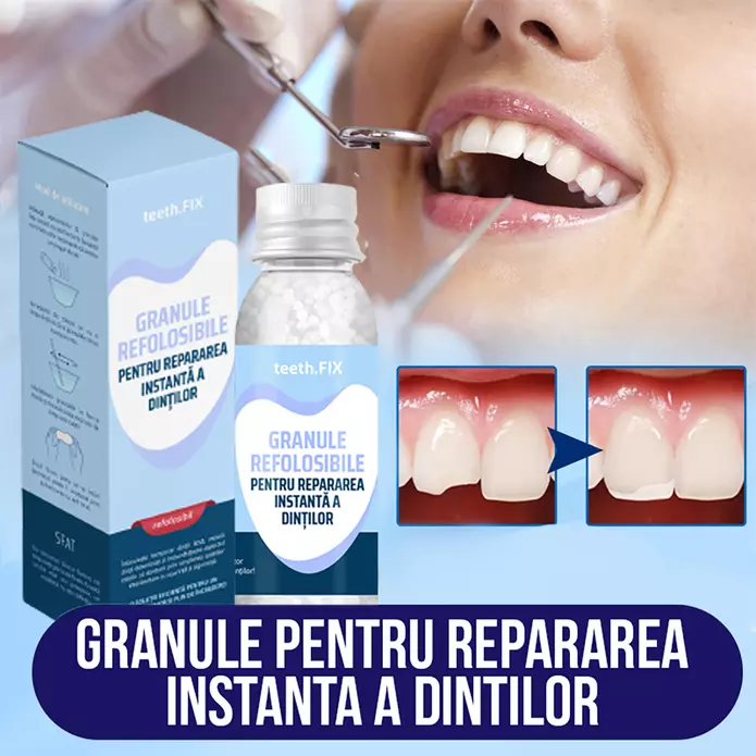 Granule Teeth.Fix pentru repararea instanta a dintilor, 30ml